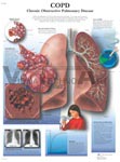 COPD - Anatomical Chart